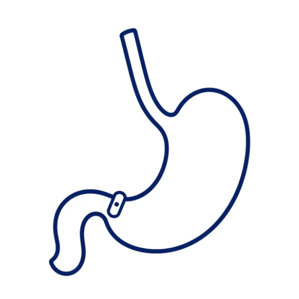 Lijnillustratie die consulten voor maagverkleining en bariatrische chirurgie bij Rehealth voorstelt